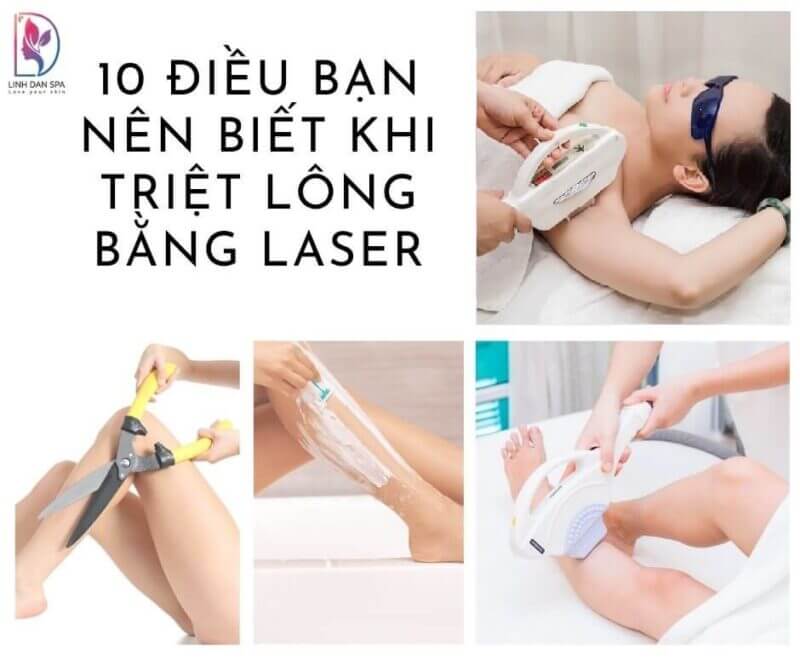 10 dieu ban can biet ve triet long laser