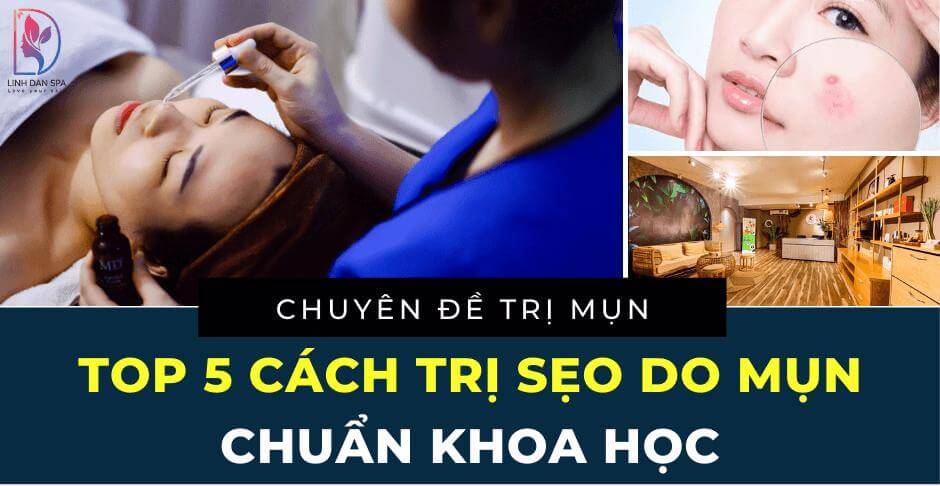 trị sẹo rỗ